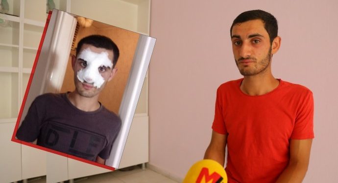 تركيا.. اعتداء عنصري على جندي تحدث باللغة الكردية!