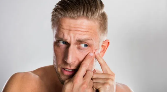 أسباب حبوب الوجه بعد الثلاثين