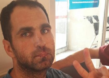 اعتداء على معتقلين بسجن بولو في تركيا باللكمات والركلات