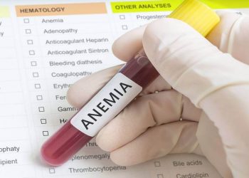 فقر الدم عند النساء.. الأسباب والأعراض