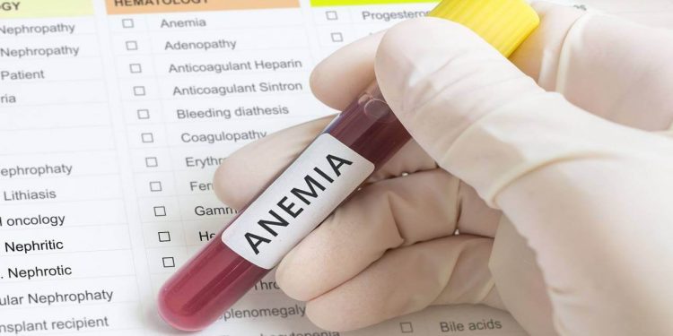 فقر الدم عند النساء.. الأسباب والأعراض