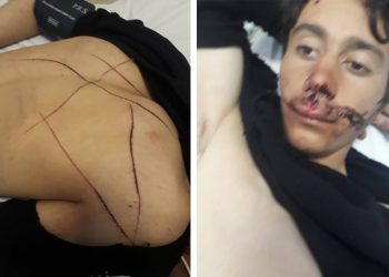 تركيا.. أنباء عن تعذيب إيراني ووفاة آخر بمركز شرطة