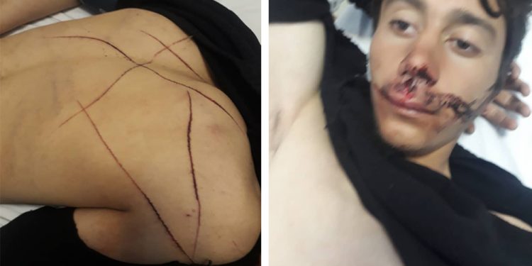 تركيا.. أنباء عن تعذيب إيراني ووفاة آخر بمركز شرطة