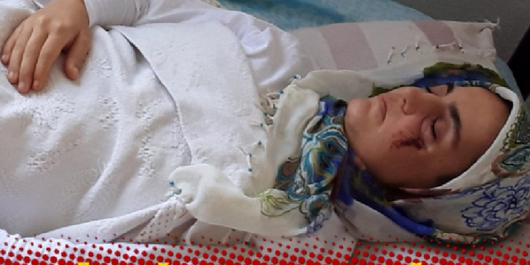 تركيا.. مريضة سرطان تتغذى عبر الأنف تواجه خطر السجن! 