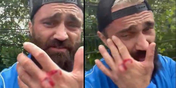 ملاكم تركي يتعرض مجددًا للاعتداء