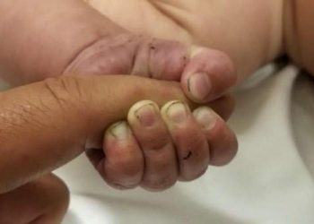 تركيا.. وفاة رضيعين في ديار بكر بفيروس كورونا