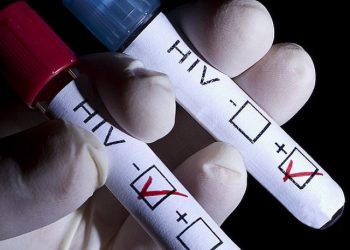 460% ارتفاع بإصابات “الإيدز” في تركيا