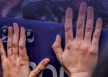 ممارسات التعذيب وسوء المعاملة في تركيا بلغت مستويات غير مسبوقة