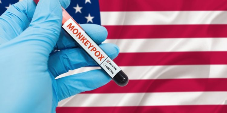 رسميًّا.. أمريكا تعلن “جدري القرود” طوارئ صحيّة في البلاد