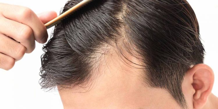 في أجسادنا نعمة اسمها “الشعر”!