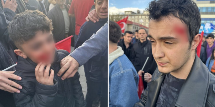 أنصار أردوغان يشيدون بالاعتدء على إمام أوغلو