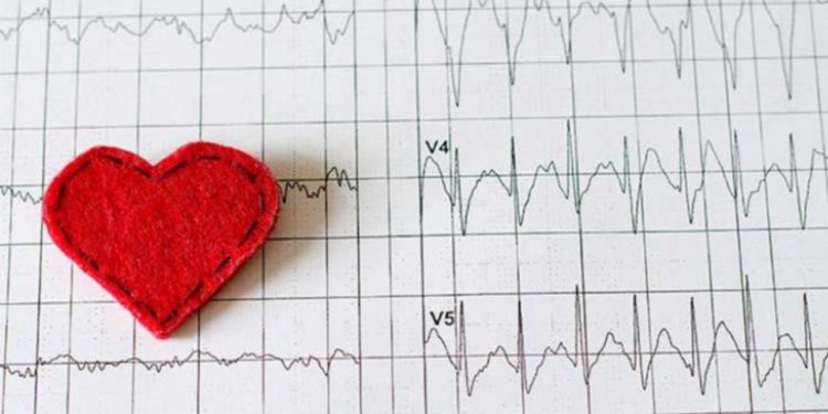 أمراض الدورة الدموية أبرز مسببات الوفيات في تركيا