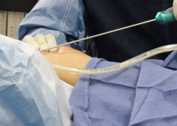 بريطانيا تحذر مواطنيها من إجراء عمليات تجميل في تركيا