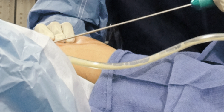 بريطانيا تحذر مواطنيها من إجراء عمليات تجميل في تركيا