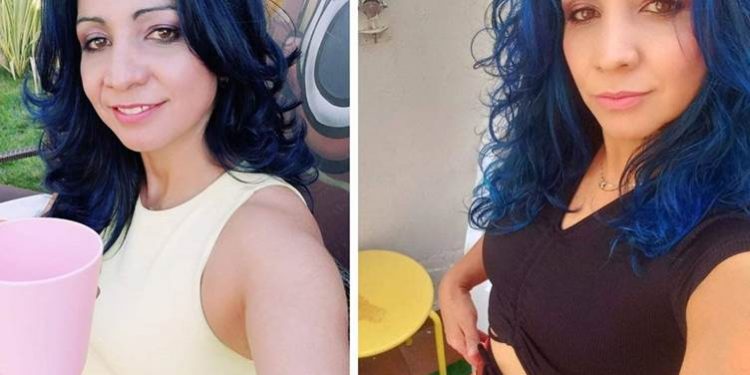 وفاة إسبانية في إسطنبول بعد عملية تجميل