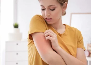 تزايد حالات الجرب في تركيا