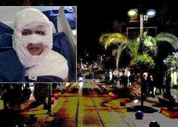 شابة تتعرض لهجوم بمادة مشتعلة في كاديكوي