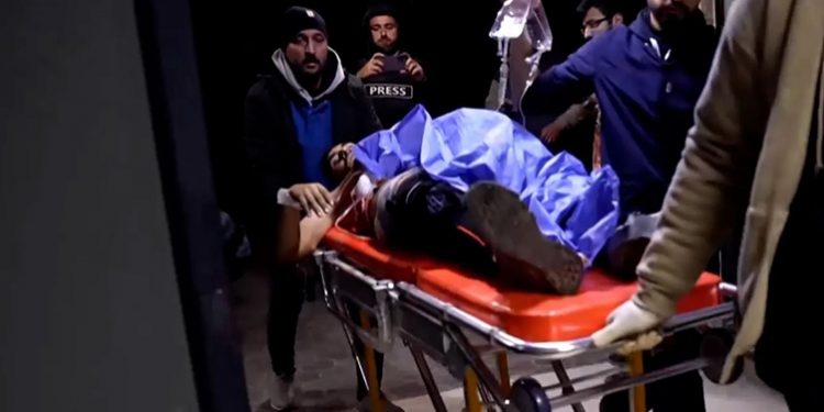 قسد تنقل جثث القتلى والجرحى من حلب